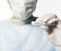 Atlikite COVID-19 molekulinį PGR tyrimą