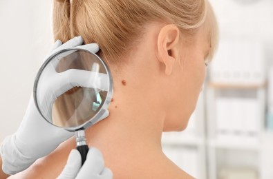 Dermatovenerologija