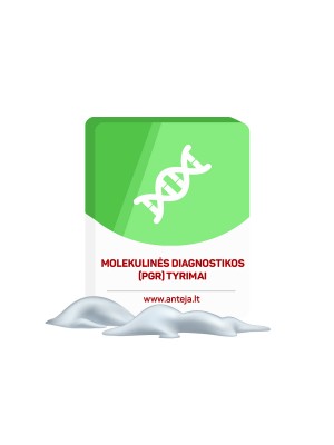 Molekulinės diagnostikos (PGR tyrimai) šlapime