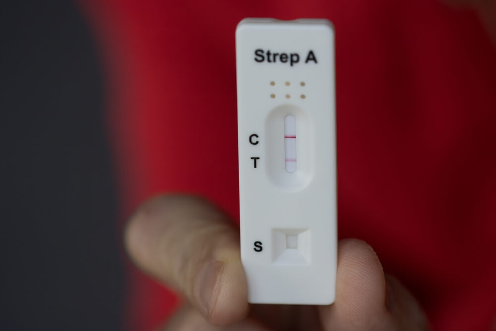 Teigiamas greitasis A grupės streptokoko (Strep A) testas su matomomis C ir T linijomis