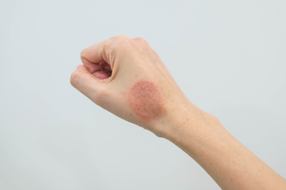 odos grybelis (nuotr. Panwa, shutterstock)