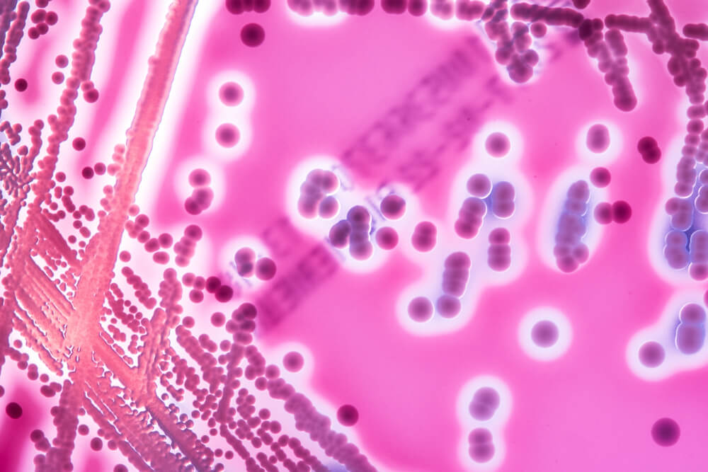Bakterijų kolonijos, išaugintos ant maitinamosios terpės laboratorinėje lėkštelėje