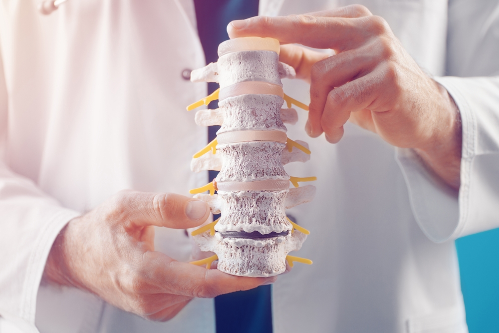 osteochondrozė